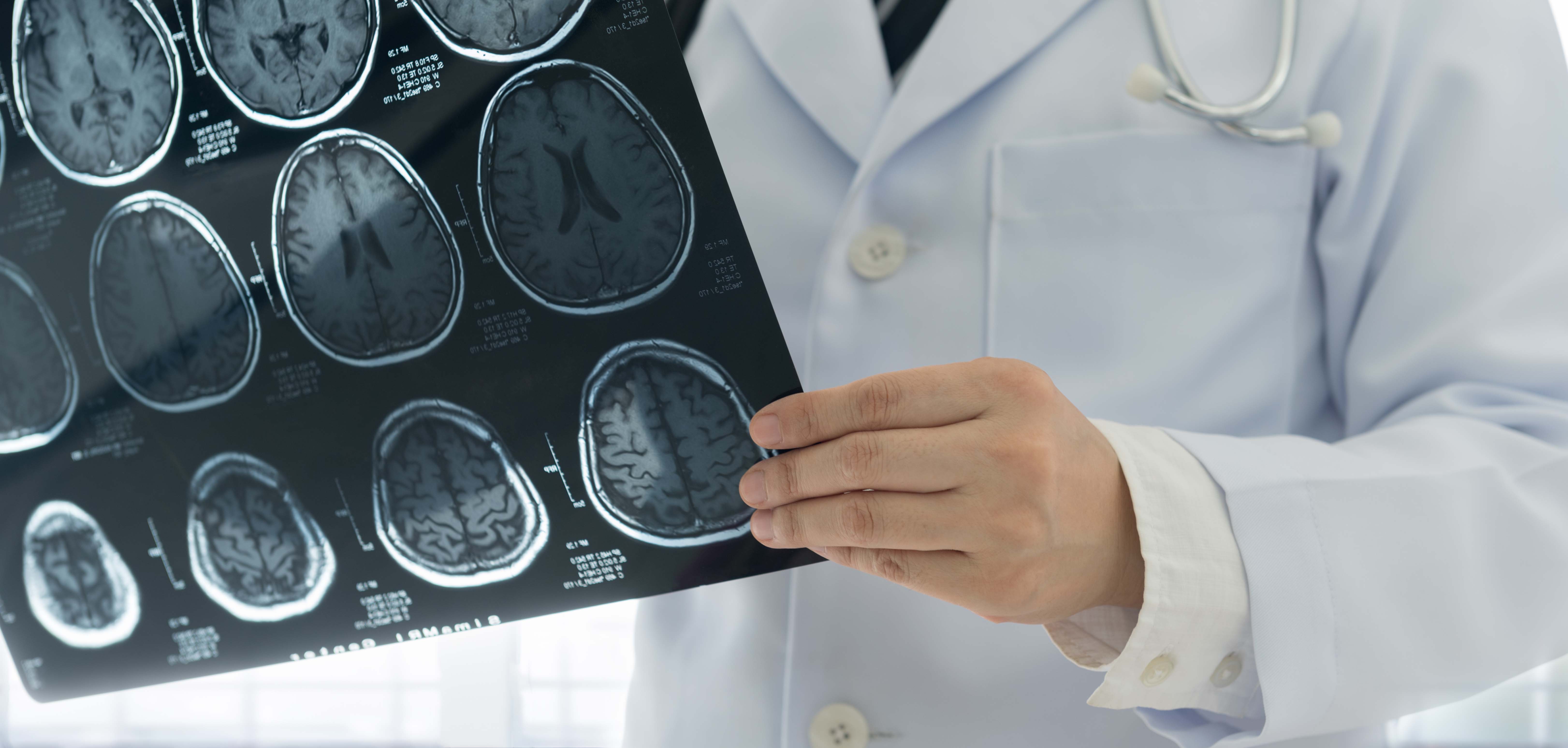 Neurologist